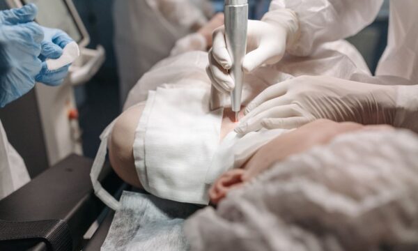 흔들림 없는 신뢰로 완성하는 모발이식, 닥터홍 성형외과 모발이식센터를 추천하는 이유